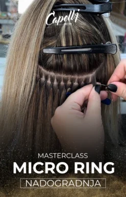 Mikro Ring Tehnika nadogradnje